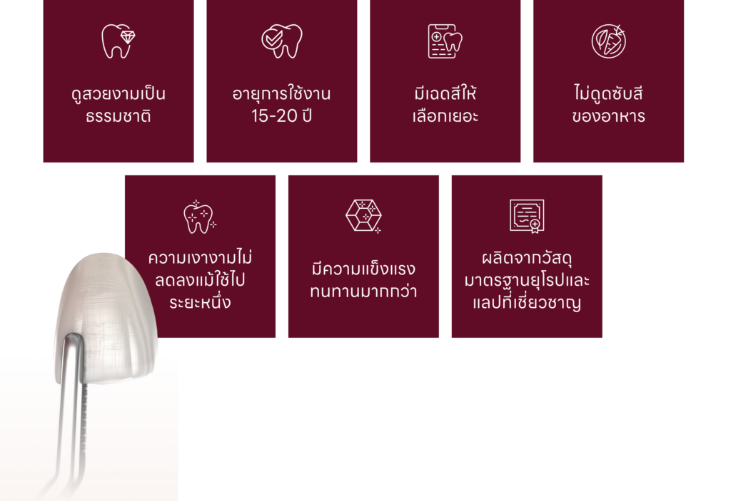 ข้อดีของ วีเนียร์
