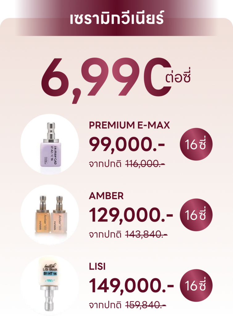 ราคา วีเนียร์ เซรามิก